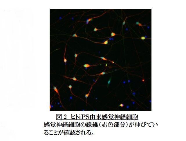 ファンケル、ヒトiPS由来感覚神経細胞の作成に成功