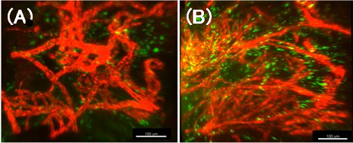 資生堂、シミ部位における血管構造異常の3D可視化に成功