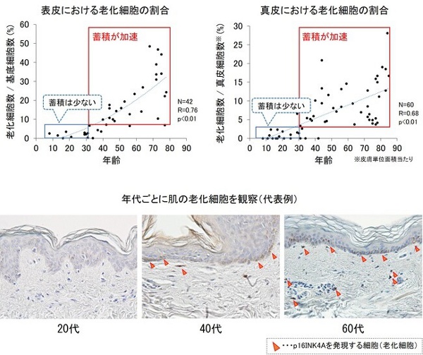 メナード、10～80代の皮膚における老化細胞の数について解析